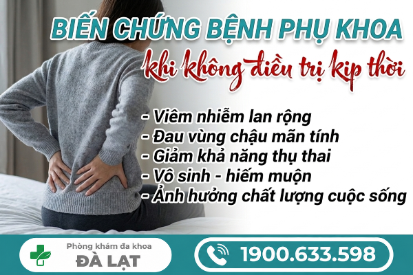 Hình ảnh minh họa